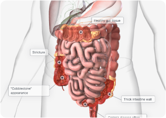 3D model of intestinal tract